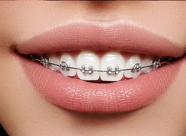 Шаблон сеню услуг6